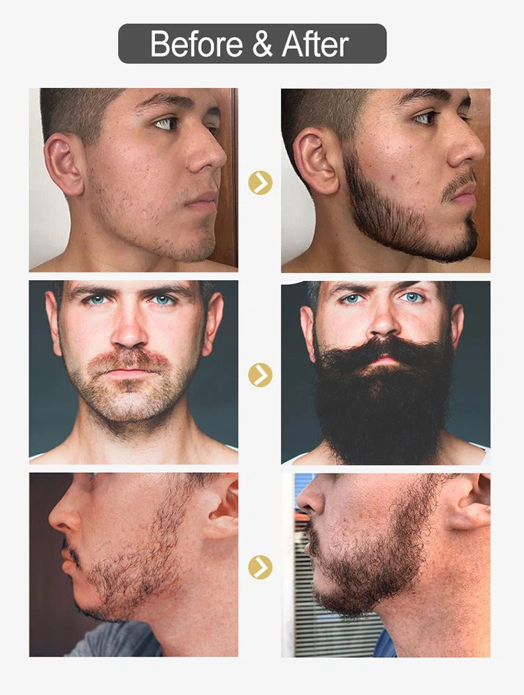 beard growth serum oil