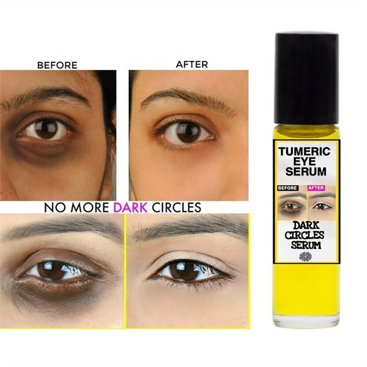 serum to reduce dark circles